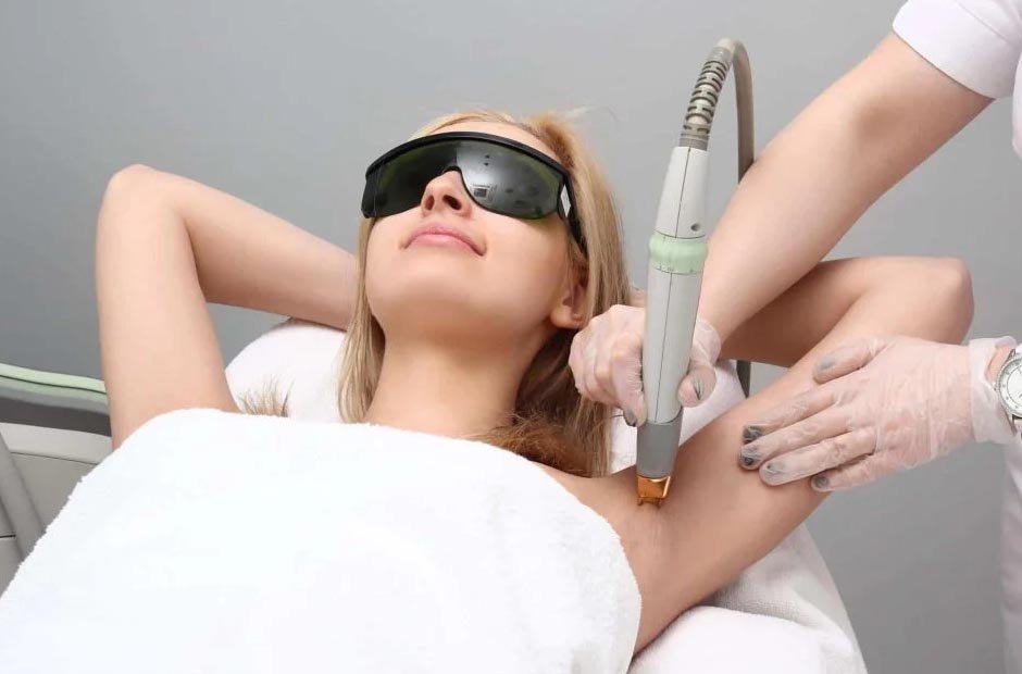 laser hair removal treatment